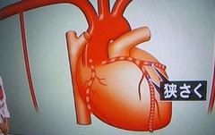 �É��̐S����p